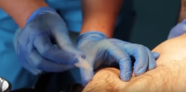 Kỹ thuật tiêm dưới da